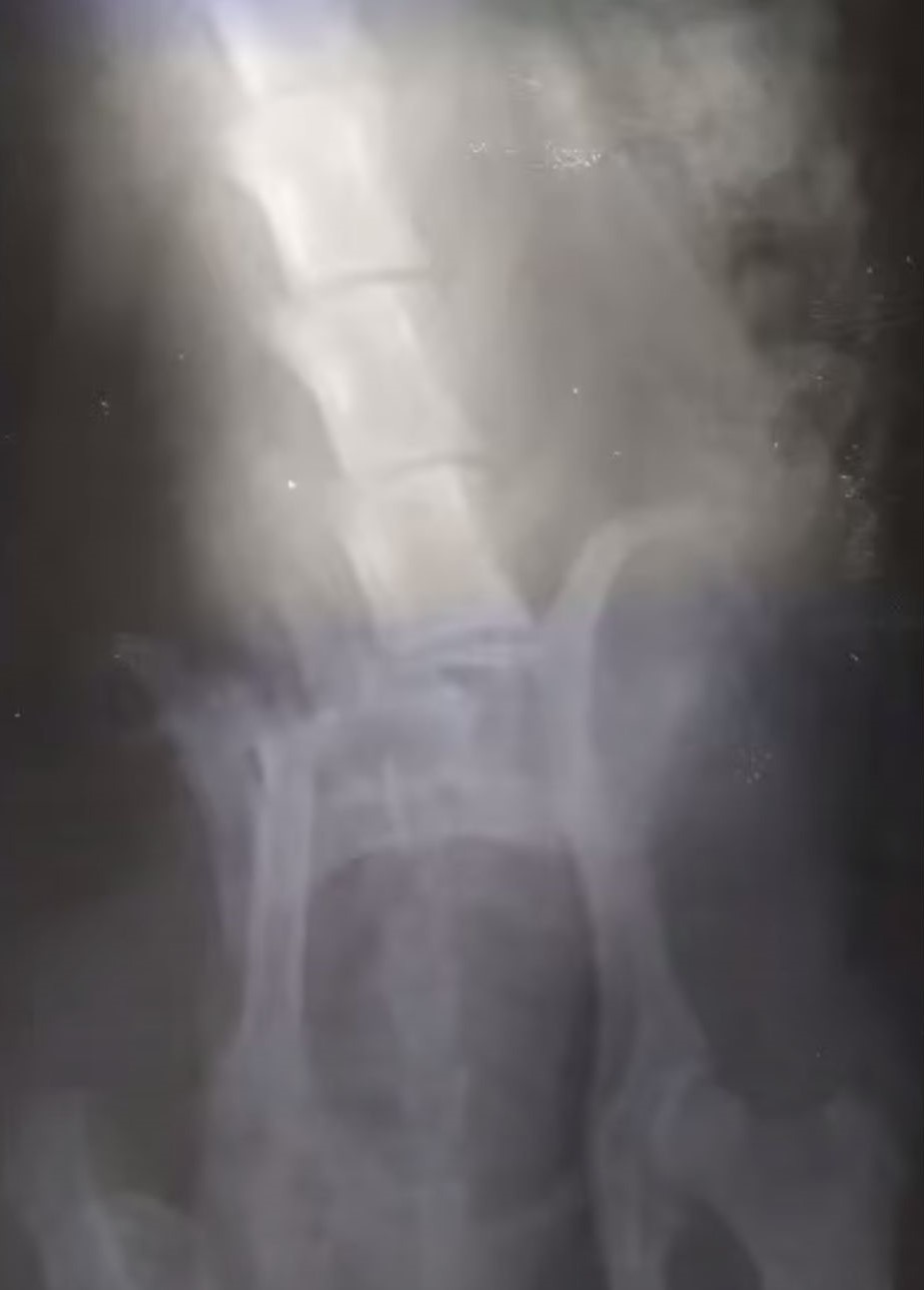 an xray picture